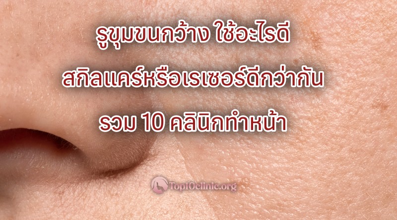 รูขุมขนกว้าง ใช้อะไรดี สกิลแคร์หรือเรเซอร์ดีกว่ากัน รวม 10 คลินิกทำหน้า รักษารูขุมขน