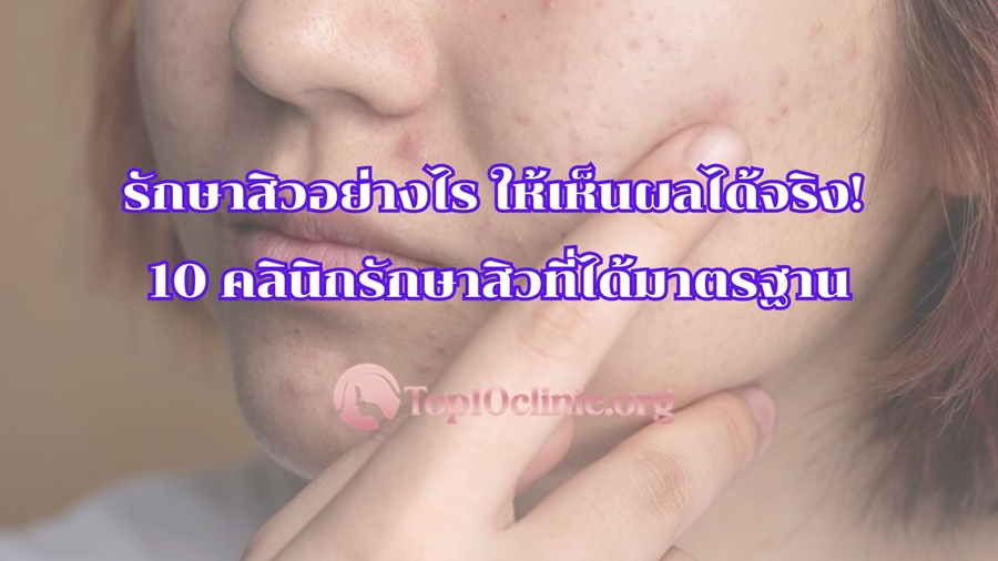 รักษาสิวอย่างไร ให้เห็นผลได้จริง! 10 คลินิกรักษาสิวที่ได้มาตรฐาน