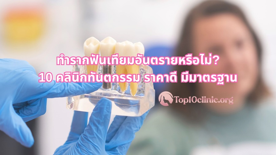 ทำรากฟันเทียมอันตรายหรือไม่? 10 คลินิกทันตกรรม ราคาดี มีมาตรฐาน