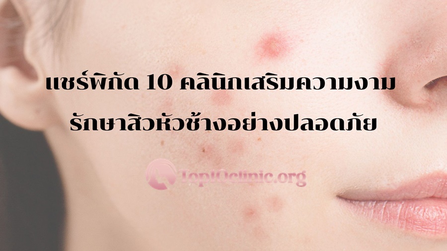 แชร์พิกัด 10 คลินิกเสริมความงาม รักษาสิวหัวช้างอย่างปลอดภัย