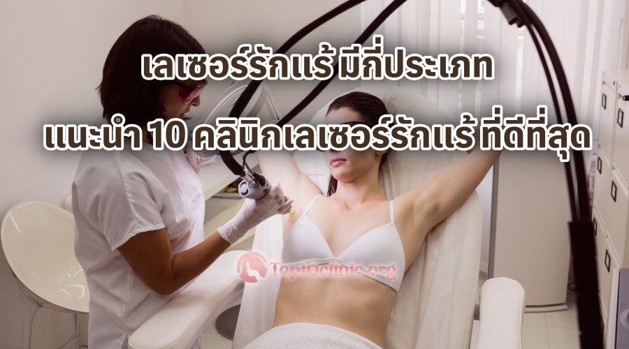 เลเซอร์รักแร้ มีกี่ประเภท แนะนำ 10 คลินิกเลเซอร์รักแร้ ที่ดีที่สุด