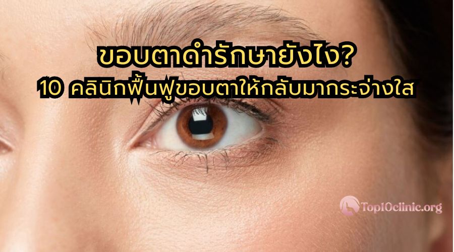 ขอบตาดำรักษายังไง? 10 คลินิกฟื้นฟูขอบตาให้กลับมากระจ่างใส